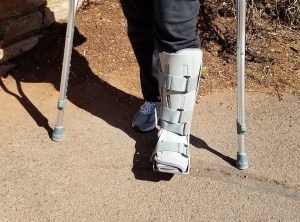 Billie and her ankle